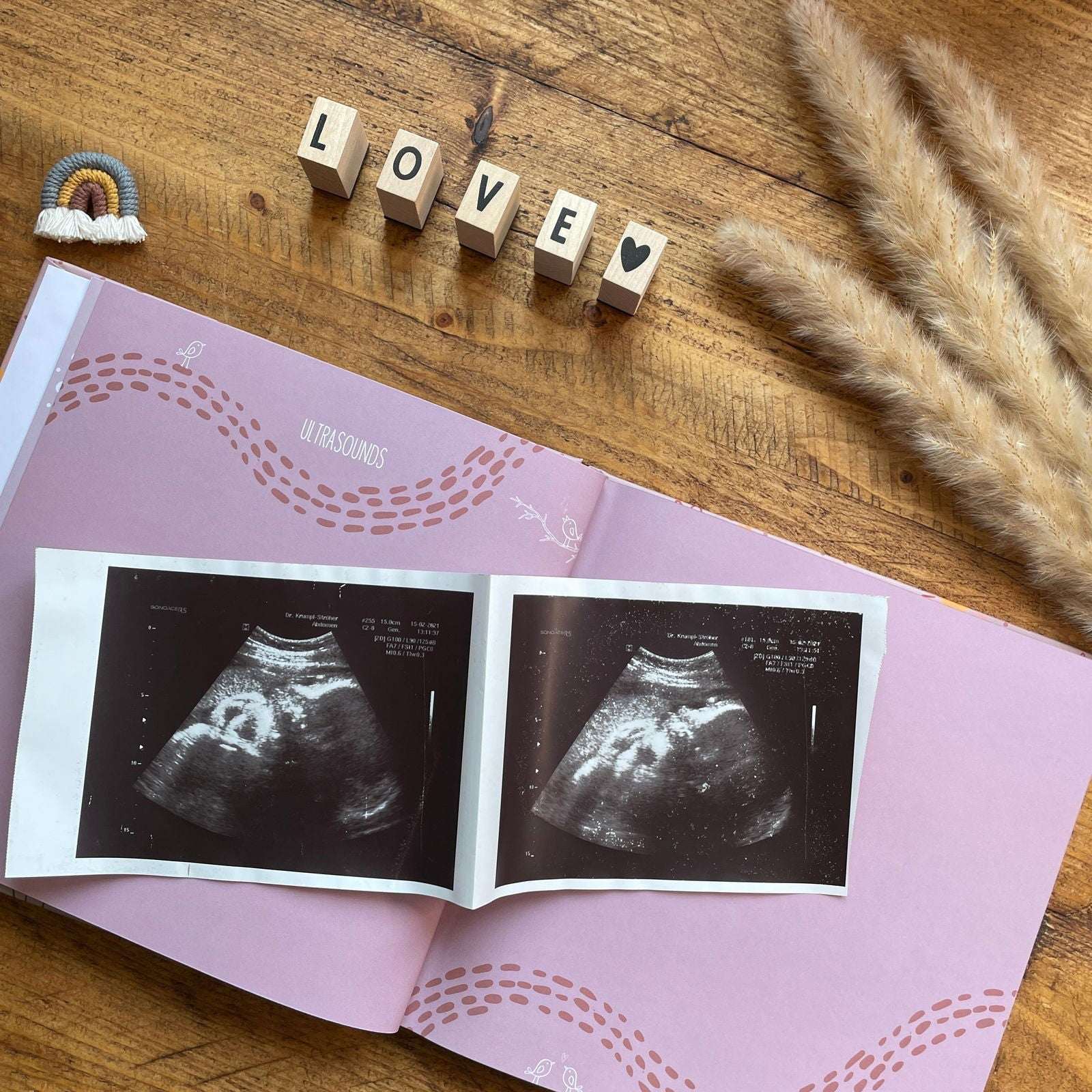 Open book with ultrasound images on a pink cover, next to wooden blocks spelling 'LOVE' on a wooden surface.